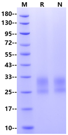 Frizzled-5/FZD5 His Tag Protein, Human