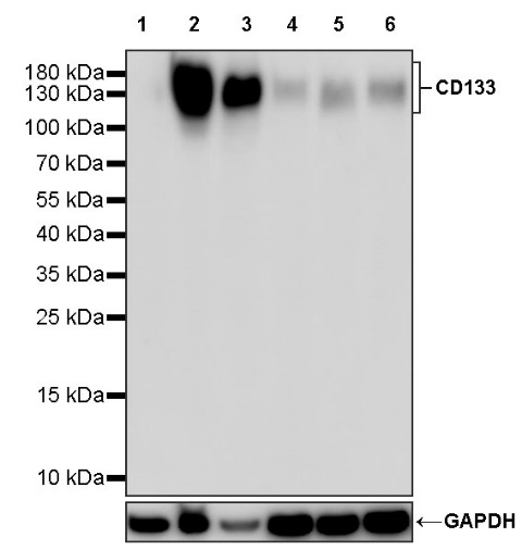 CD133 Recombinant Rabbit mAb(SDT-1295-22)