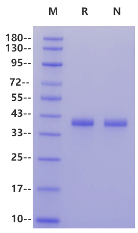 Galectin-4 His Tag Protein, Human