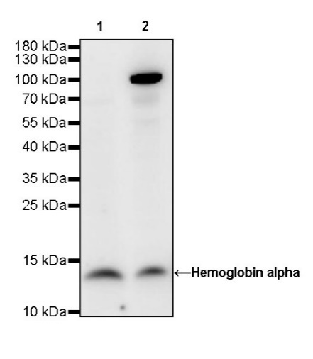 Hemoglobin alpha Recombinant Rabbit mAb (S-R242)