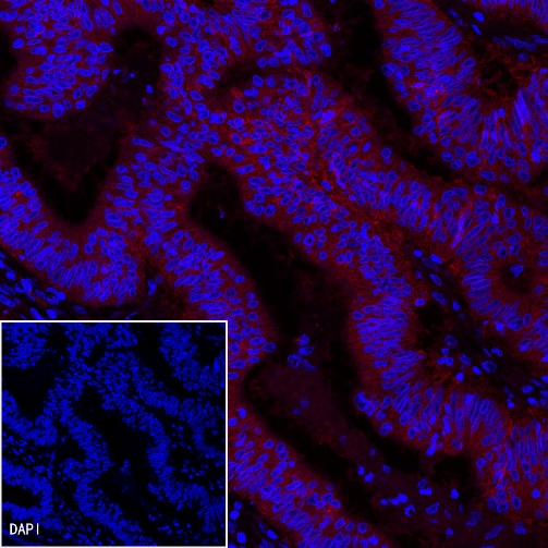 EpCAM Recombinant Rabbit mAb (PE Conjugate) (S-078-13)