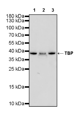 TBP Recombinant Rabbit mAb (S-886-57)