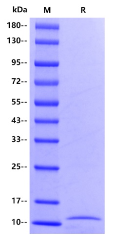 Human S100A4 Protein, His tag