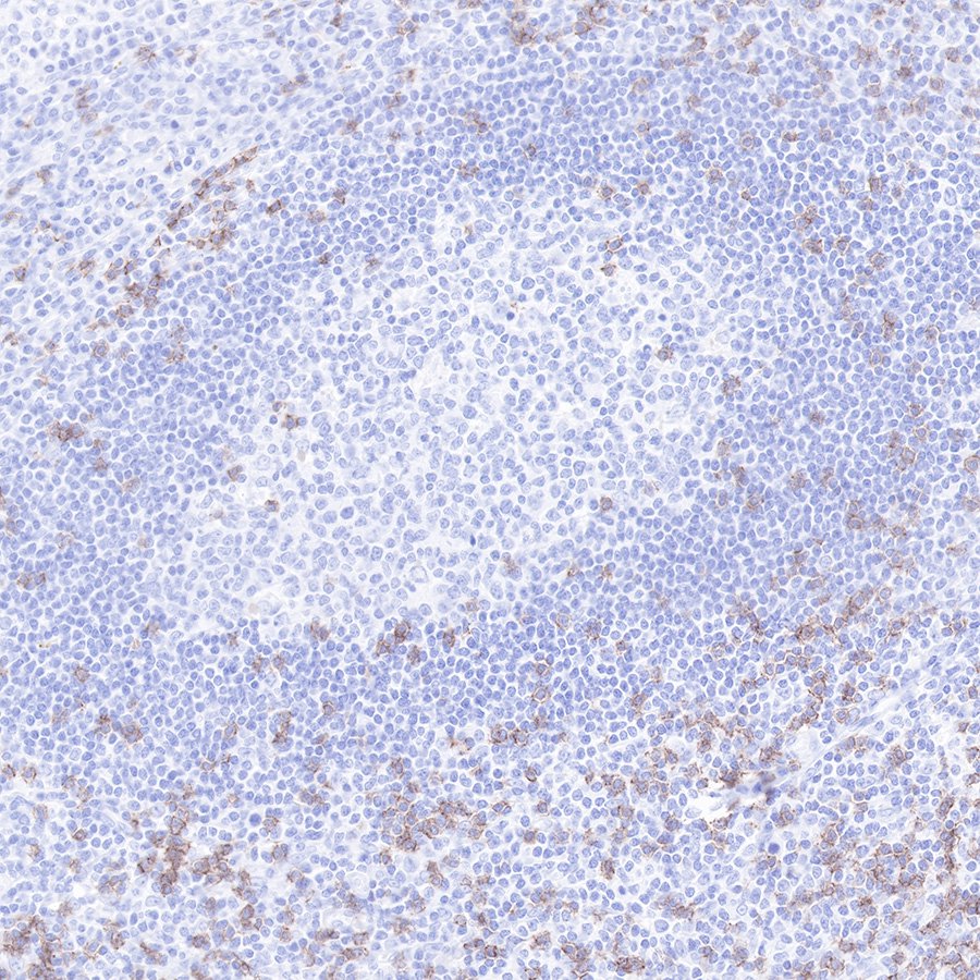 CD8α Mouse mAb(SDT-126-8.3)