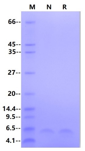 HBV Surface Antigen-preS2