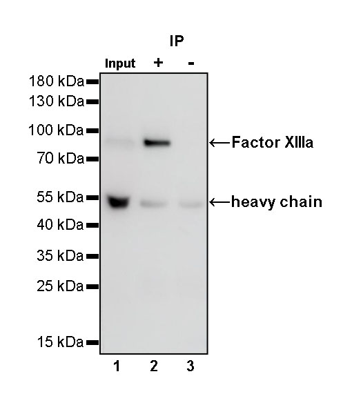 Factor XIIIa Recombinant Rabbit mAb (SDT-644-7)
