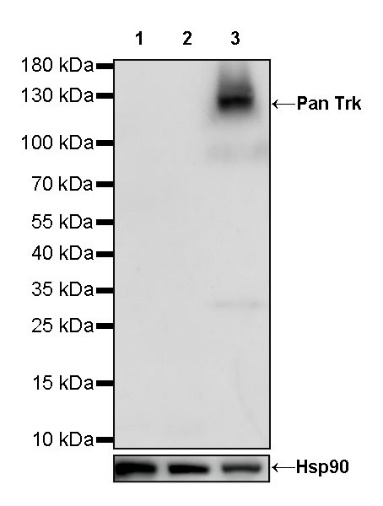 Pan Trk Recombinant Rabbit mAb (SDT-400-39)