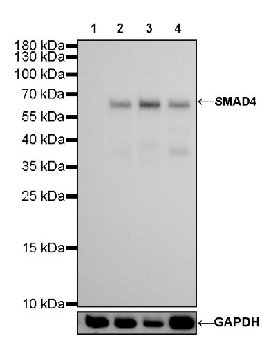 SMAD4 Recombinant Rabbit mAb (SDT-168-62)