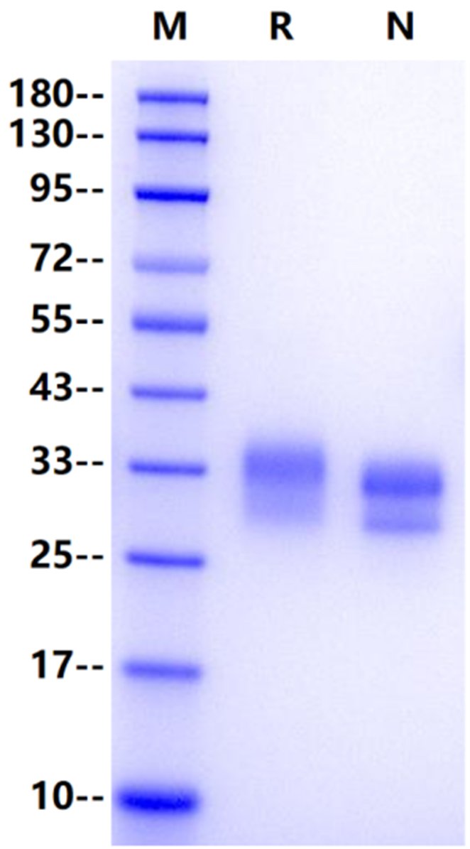 LTBR/TNFRSF3 His tag Protein, Human