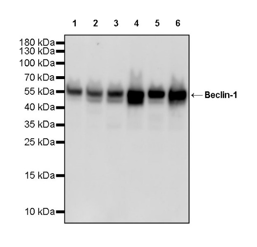Beclin-1 Recombinant Rabbit mAb (S-761-15)