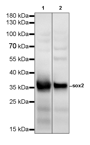 SOX2 Recombinant Rabbit mAb(SDT-066-58)