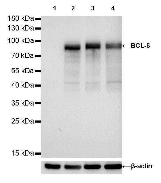 S-RMab® BCL-6 Recombinant Rabbit mAb (SDT-103-21)