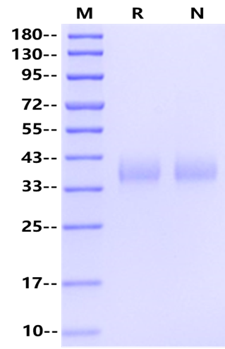 Galectin-3 His Tag Protein, Human