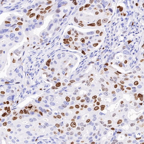 S-RMab® Ki67 Recombinant Rabbit mAb (SDT-10002)